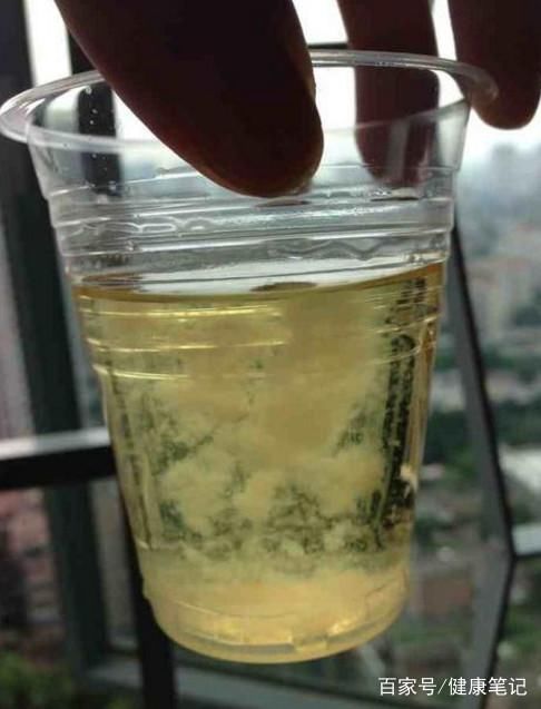 生男生女早知道!教你一个小方法,在家自测胎儿