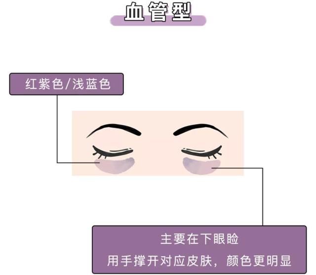  『刷屏』问壹点｜“本人黑眼圈证明”刷屏？壹起扒一扒黑眼圈的前世今生