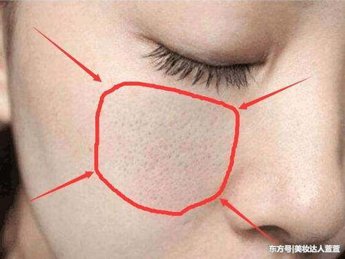 3个损害出现脸上,说明皮肤遭受螨虫摧残,只需用到2招可排空