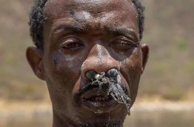 采盐人活着的痛苦:眼瞎,耳聋,器官腐烂!