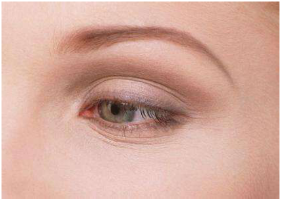 眼下皱纹怎么消除 去除眼部皱纹的好方法