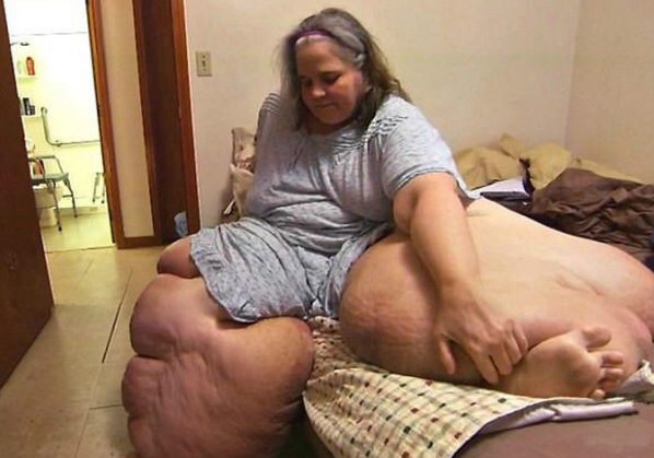 她重达550斤，光腿就重约400斤，每生一个孩子重100斤