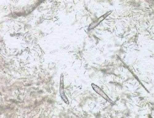 脸上没有螨虫的3大迹象，看看你占了几个?