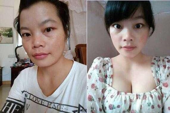 白醋加它好神奇，早晚擦擦脸，祛斑美白又祛痘，让你肌肤永远18岁