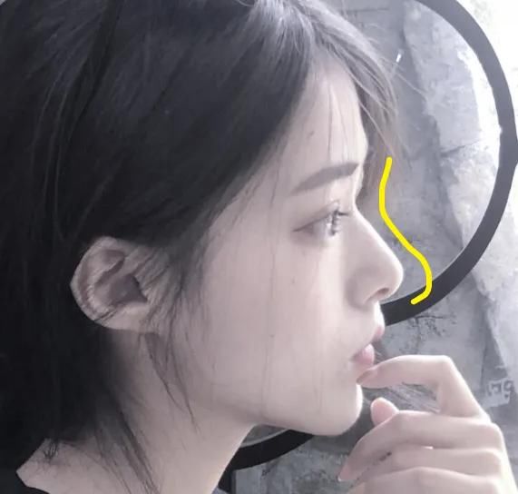  『逆袭』“草莓鼻”女孩的逆袭：去黑头的“3个正确大招”，教你一学就会