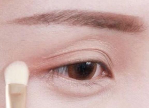 惊!戚薇开眼角了?还是无痛的