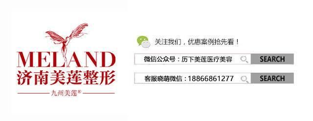  #小编建议#单眼皮与双眼皮的江湖，为什么双眼皮总能获得青睐？