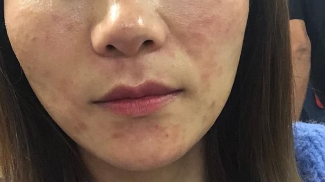  「人群」壹知肤:拼命美白却还是白不了?坚持这3个美白方法,你可能早就白了