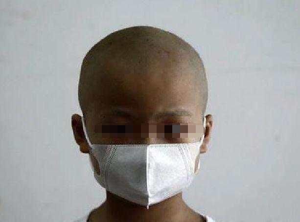 4岁宝宝整日没精神还发高烧, 患上白血病, 还用