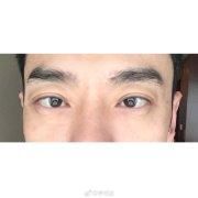 男星尴尬部位被蚊子咬后，导致整个剧组停工，网友：想上手摸一把