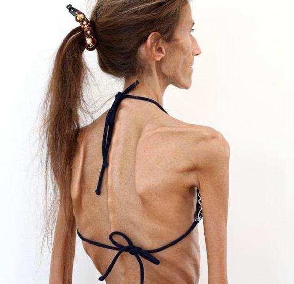 长期不吃肉,到底会减肥成功还是失败?让营养师告诉你真相