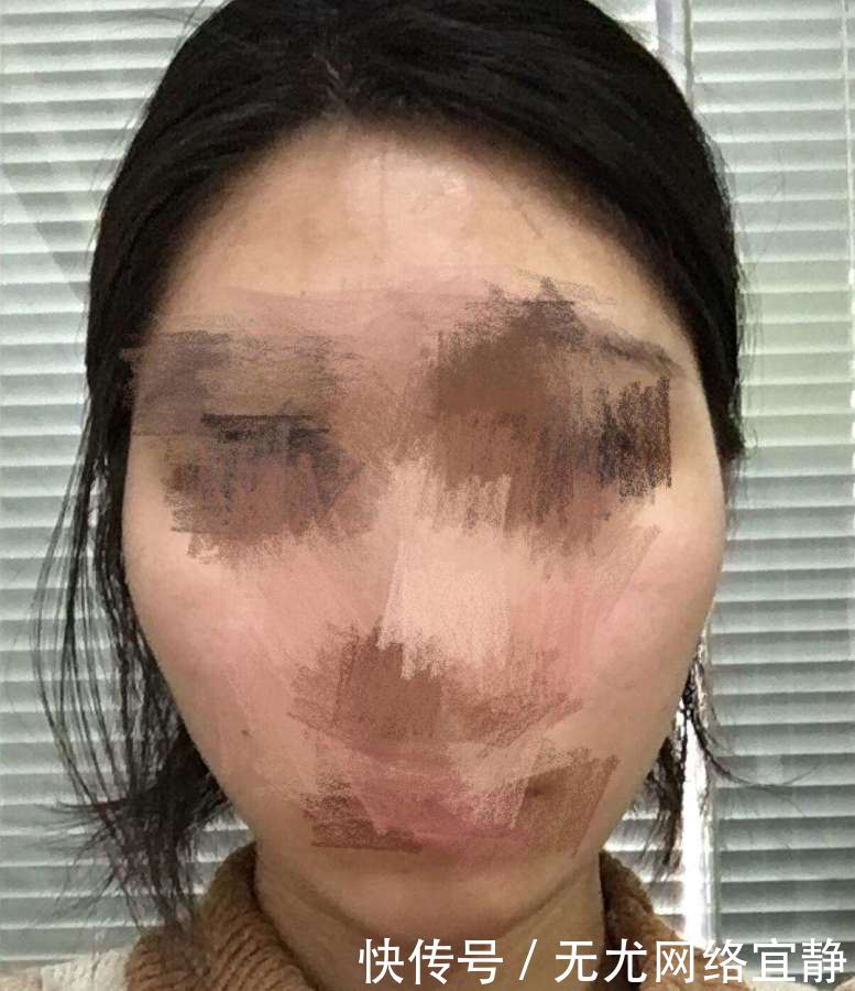 #女生#长相难看的女生一般脸上有这3个特征!中一个就很容易被嫌弃