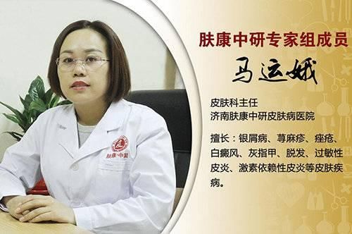  『长痘痘』毛孔收敛水真能缩小毛孔吗？脸上有痘不要愁，教你几招祛痘小窍门