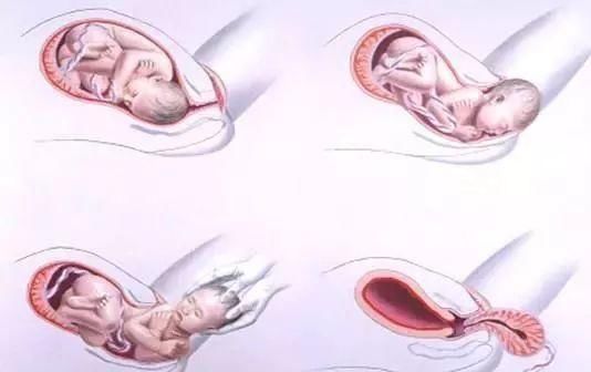 怀孕后B超单上这两项指标越正常,说明胎儿越健
