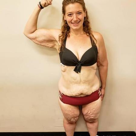 胖妞2年瘦300斤，网友赞她变女神，她却展示老太太一样的身体