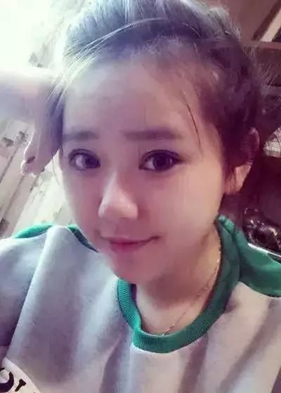 双眼皮+开眼角=我魅力大眼！