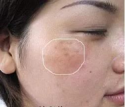 《如懿传》周迅的囧途，你若同有，一步治好!