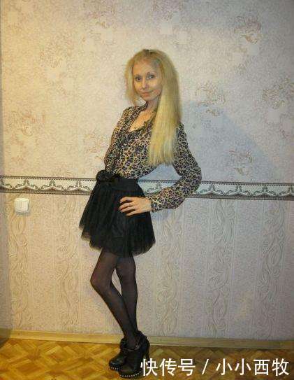 少女因害怕身体走形，每天坚持只喝水不吃食物，如今成“活骷髅”