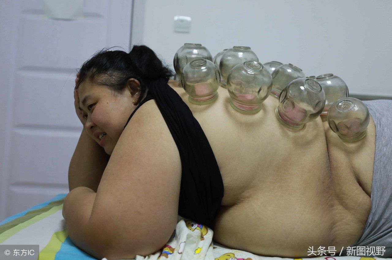 女子体重380斤，为生孩子曾立遗嘱，现励志减肥照顾儿子