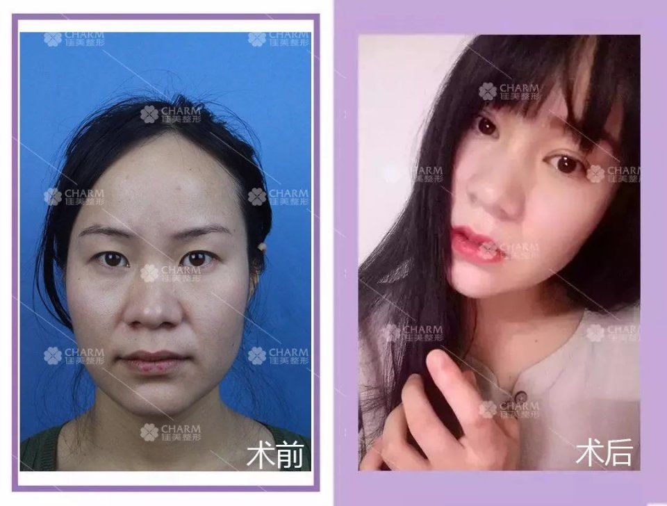 变美是一种什么样的体验?看完扎心了