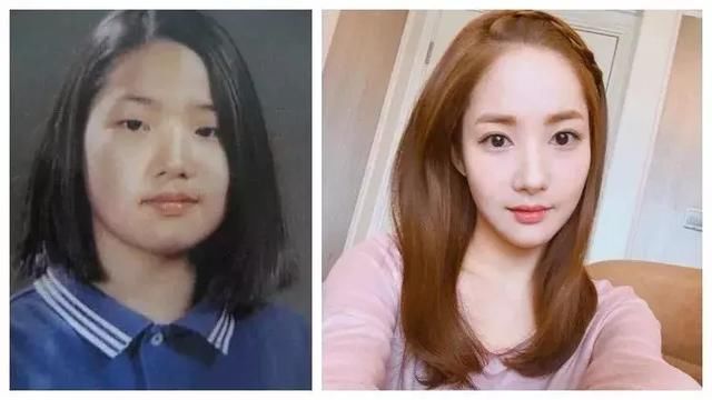 谁说整容太多脸会崩？这些明星用实力给大家辟谣！