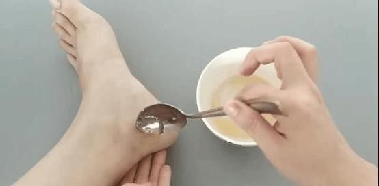  「女人」女人的这个“问题”,用红霉素软膏加蜂蜜就可以解决,用过都说好
