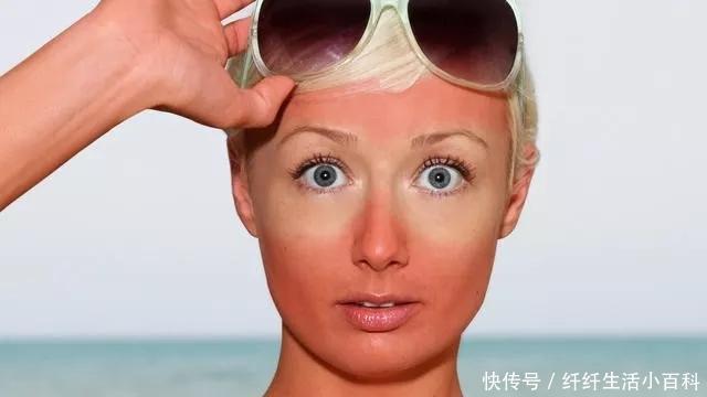 百科■瘦百科18水龄:春季踏青忙,晒后修复不能忘!