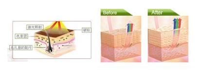 黑脸娃娃：色斑、暗黄统统甩开