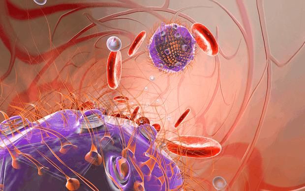 血管里的斑块可以清除吗?