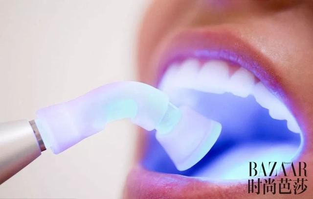 吴宣仪“牙龈笑”好甜！关于美牙你还得知道这些！