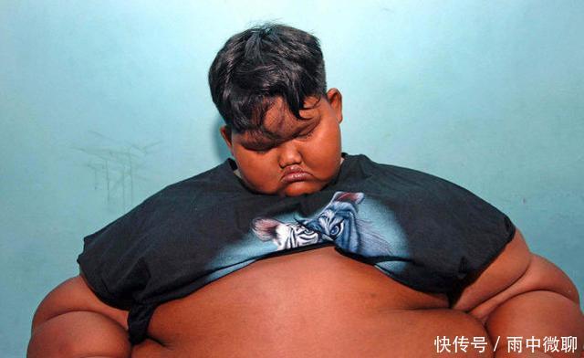 曾经那个世界最胖的男孩！体重384斤，减肥152斤后变帅小伙