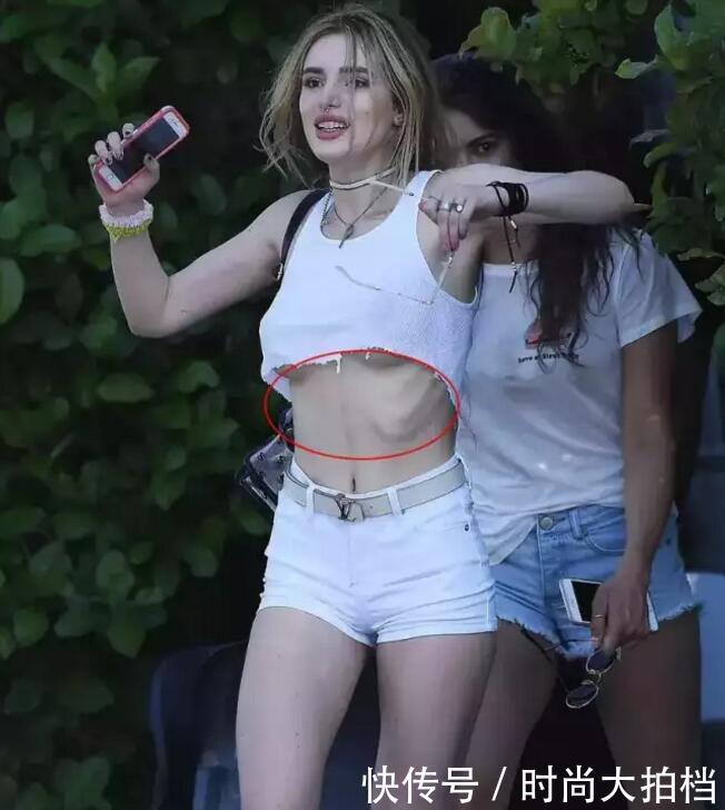 讲真，孟美岐“肋骨外翻”上热搜，其实是众多爱美女孩的高能预警