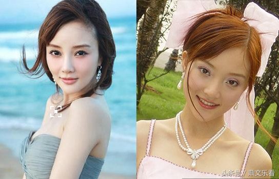 李小璐本来整的挺美挺性感的 还不满足结果整容过度导致脸部扭曲