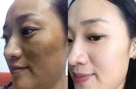 老中医绝密偏方:农村大妈用“它”每晚抹脸一次，肌肤白嫩如雪!