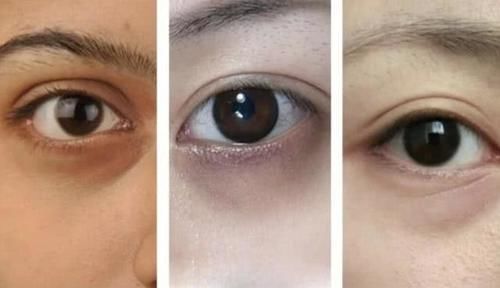  「眼霜」熬夜党必备眼霜，不轻易盲目于大牌，平价也有好用产品