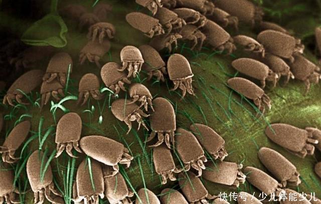 「螨虫的生」卧室螨虫成窝,广东宝妈一招把螨虫彻底去除,螨虫1只也找不到