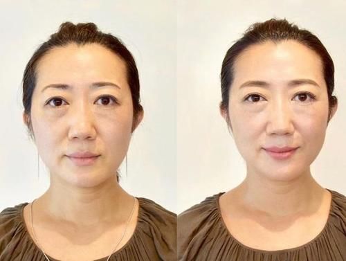  【化妆能】老妈妆发｜用普通人的对比照片告诉你，年纪越大越要化点妆！
