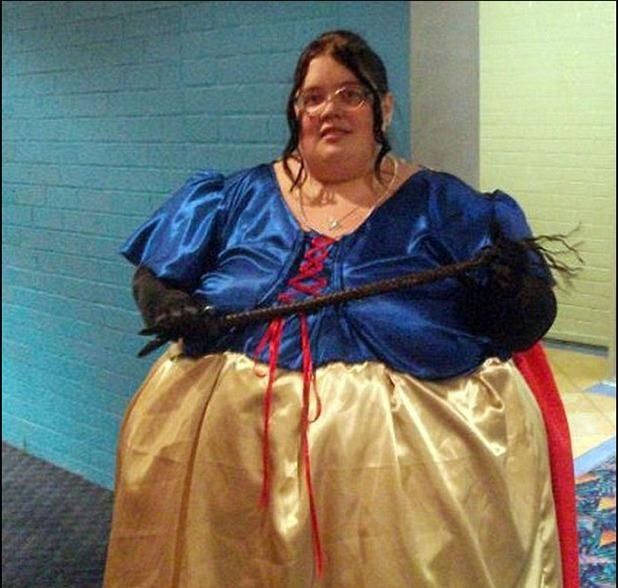 女子通过手术减肥260斤，然而后遗症却让她后悔终身！