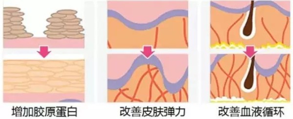 苏州紫馨逆龄术--让年龄成为秘密，悦升线苏州区首发