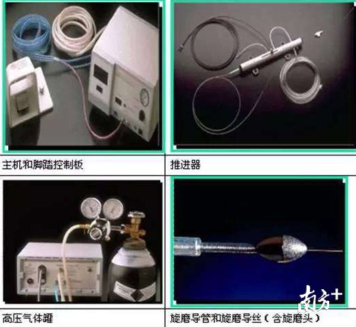  瓷器：老人冠状动脉钙化脆如瓷器，医生巧用“金刚钻”打通