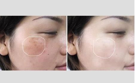 药店墙角一不起眼白色乳液，每晚涂一涂，满脸胶原蛋白