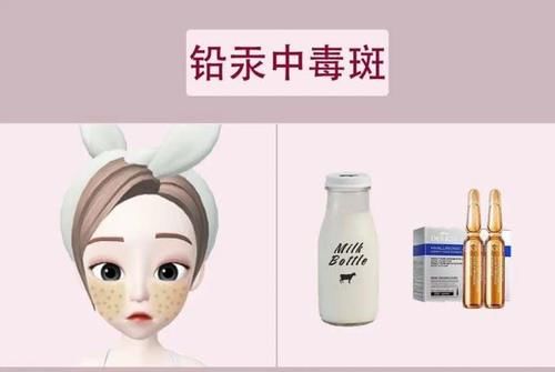  预防：脸上的斑点是如何形成的？看看这4种你有没有，最后一种可预防