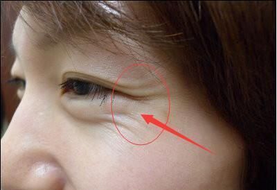 女人40岁有皱纹别傻傻去打玻尿酸, 用点厨房便宜货