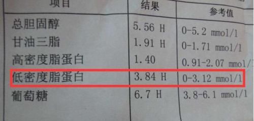  突发：61岁老伯脑梗突发，医生：这个指标是脑梗的“风向标”，别忽视