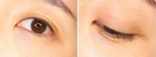 女子25年不卸妆竟长出结石!看完实在令人毛骨悚然……