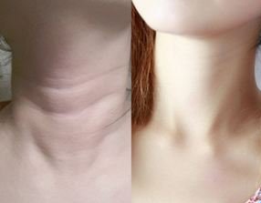 新发现，药铺又一种便宜乳膏，睡前挤点涂脸，脖子，纹乖乖跑