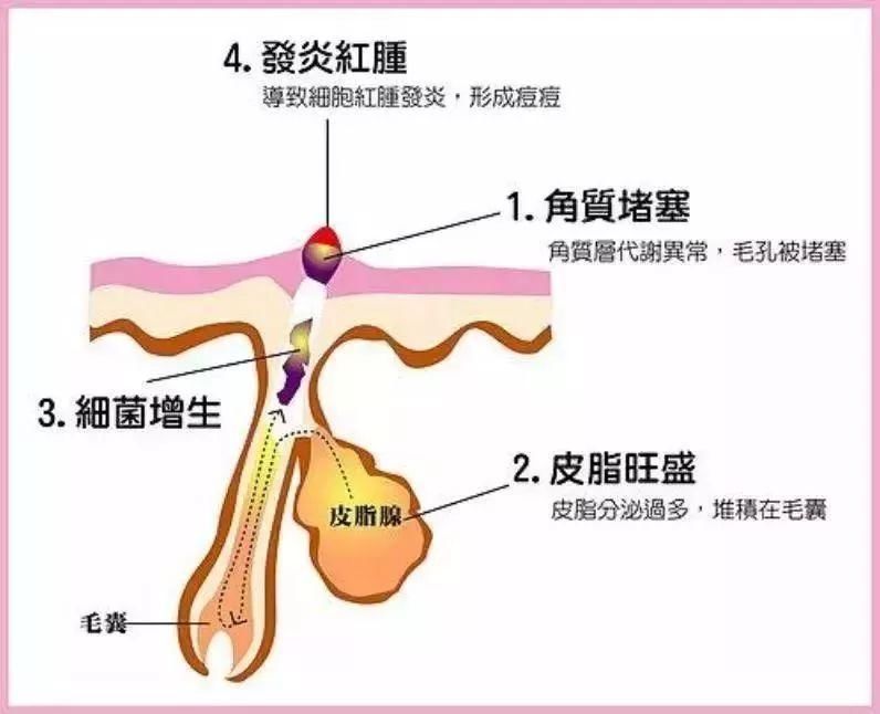 别再让这些护肤谣言毁了你的脸，第5条你肯定踩过坑!