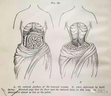 古代欧洲美女对美的追求，是对身体残忍的虐待