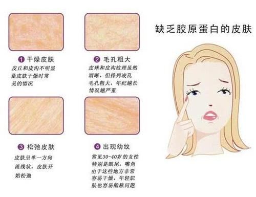 「恢复」30+女生皮肤变松垮,怎样才能恢复到18岁的紧致脸?
