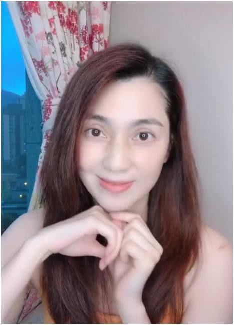 「泛红」49岁著名女星晒素颜照,露头皮疑似脱发,胳膊上泛红伤痕引担忧